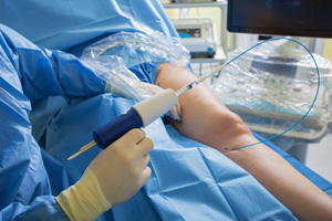 Chirurgie vasculaire