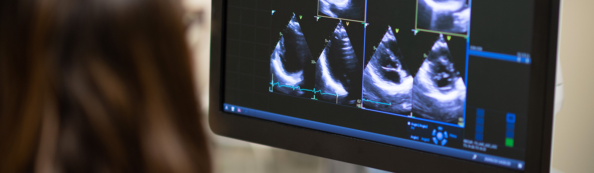 Centre Cardio-vasculaire de la Sauvegarde