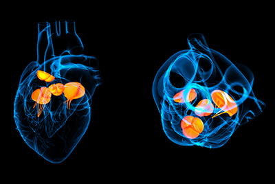 Valves cardiaques
